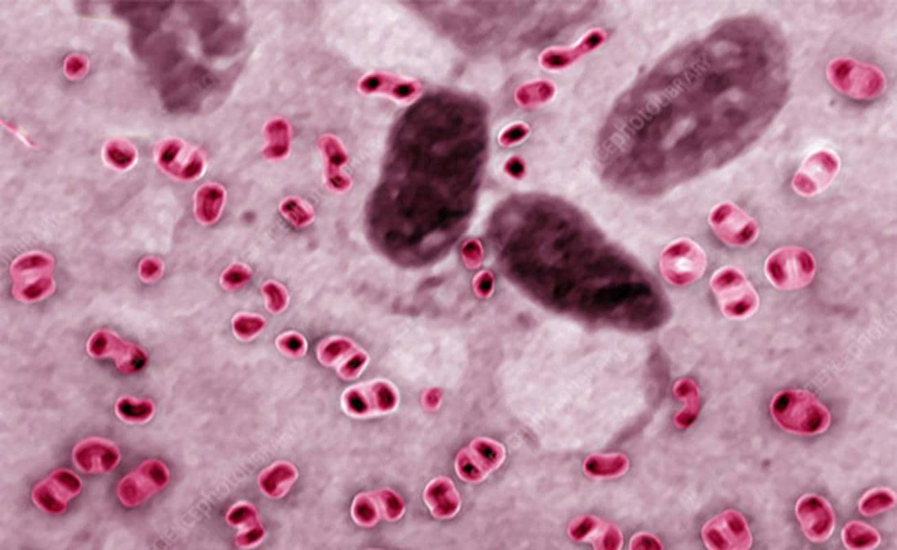 virus-gay-tu-huyet-trung-o-ga.jpg